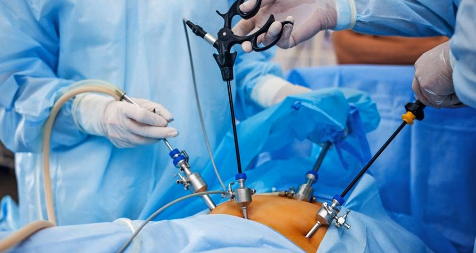 ¿Qué desventajas tiene la cirugía laparoscópica en comparación con la cirugía abierta?